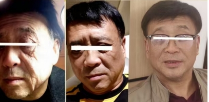 回归本源，让疤痕收回本该易防易治的本来形象！