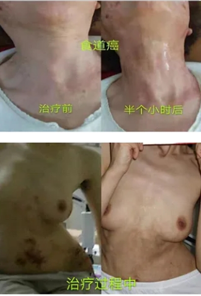 王军安：中医界的传奇开拓者，揭秘瘫痪之谜