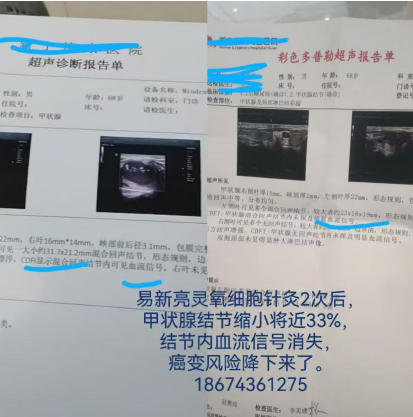 易新亮 开启新冠后遗症、三高糖尿病、风湿免疫病、肿瘤的康复新纪元