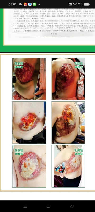 防癌·抗癌·灭癌——关爱健康（专利论文） 杨宗仙专家