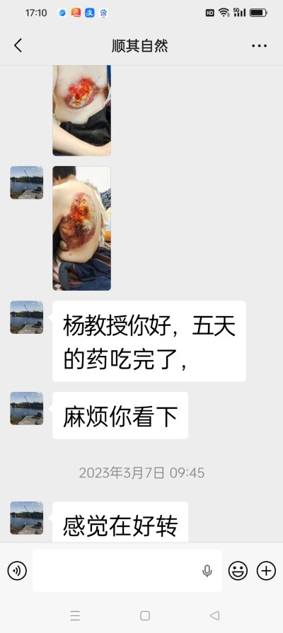 防癌·抗癌·灭癌——关爱健康（专利论文） 杨宗仙专家