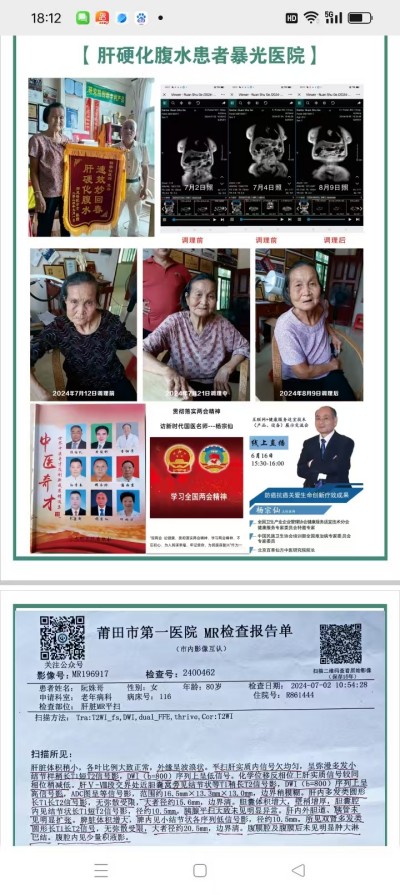 防癌·抗癌·灭癌——关爱健康（专利论文） 杨宗仙专家