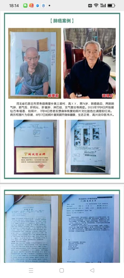 防癌·抗癌·灭癌——关爱健康（专利论文） 杨宗仙专家