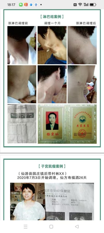 防癌·抗癌·灭癌——关爱健康（专利论文） 杨宗仙专家