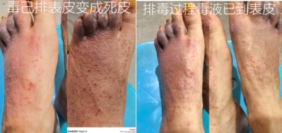 防癌·抗癌·灭癌——关爱健康（专利论文） 杨宗仙专家