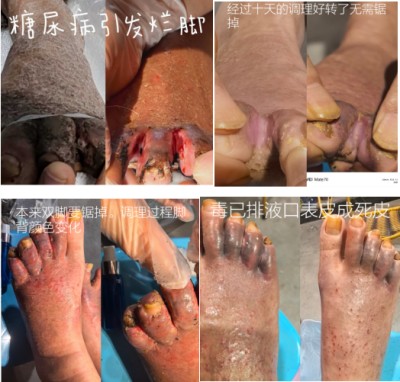防癌·抗癌·灭癌——关爱健康（专利论文） 杨宗仙专家