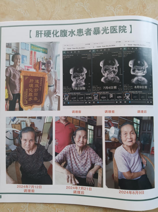 半世纪深耕岐黄，专利仁术济苍生——国医大师杨宗仙的中医济世传奇