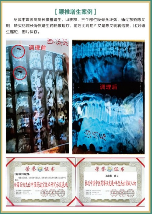 礼赞八一专题报道 著名国医大师---杨宗仙
