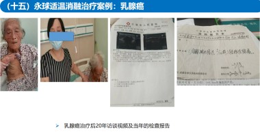 适温消融技术的临床应用与革新