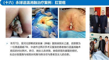 适温消融技术的临床应用与革新