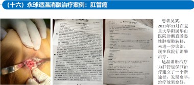 适温消融技术的临床应用与革新
