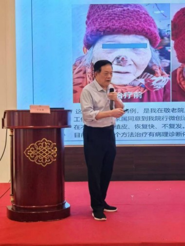 适温消融技术的临床应用与革新