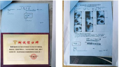 关爱生命：杨宗仙与仙防癌抗癌灭癌中医实践