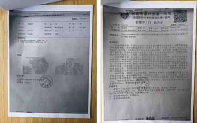 关爱生命：杨宗仙与仙防癌抗癌灭癌中医实践