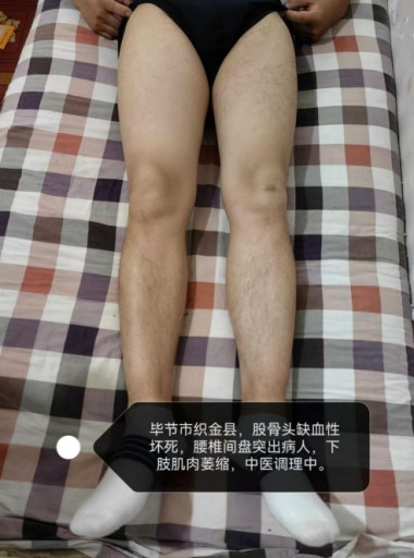 传承中医瑰宝,守护百姓健康 著名贵州名医---王家贵